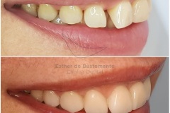 24-caso-clinica-dental-esther-de-bustamante