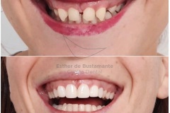 47-caso-clinica-dental-esther-de-bustamante