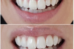 69-caso-clinica-dental-esther-de-bustamante